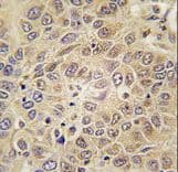 Polyclonal Rabbit anti-Human MARS Antibody (aa872-899, IHC, WB)