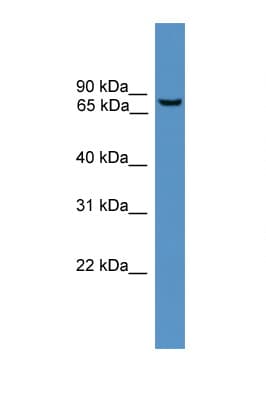 Polyclonal Rabbit anti-Human BBS2 / BBS Antibody (aa151-200, WB)