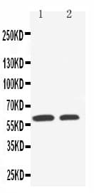 Polyclonal Rabbit anti-Human SLC22A1 Antibody (aa533-550, WB)
