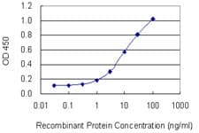 Monoclonal Mouse anti-Human CD5 Antibody (clone 2F7, WB)