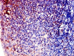 Polyclonal Rabbit anti-Human ARPC1B / p41-ARC / ARP2 Antibody (IHC)