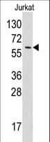 YARS / Tyrosyl-tRNA Synthetase Antibody (aa160-190)