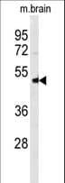NPTX1 Antibody (aa322-350)