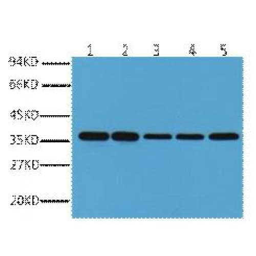 Monoclonal Mouse anti-Human GAPDH Antibody (clone 2B8, IHC, WB)