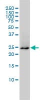 Monoclonal Mouse anti-Human GRB2 Antibody (clone 4C6-H6, WB)