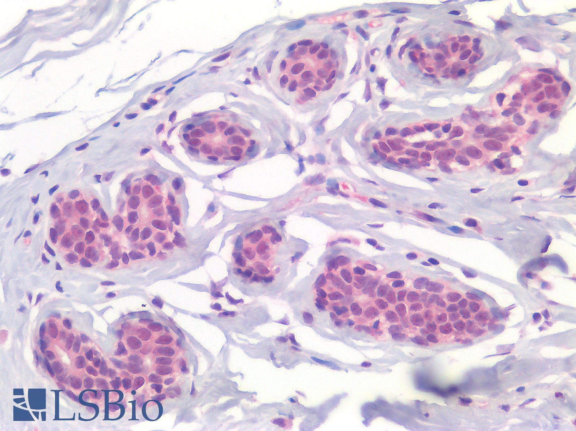 IHC-plus™ p14ARF / CDKN2A Antibody