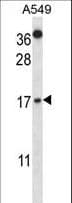 CSTA / Cystatin A Antibody (aa69-98)