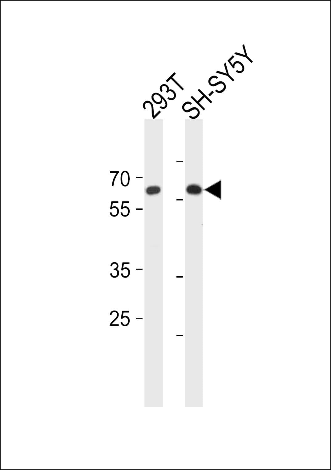 Polyclonal Rabbit anti-Human IRX3 Antibody (aa111-140, IHC, WB)