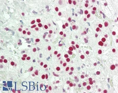 IHC-plus™ PRMT1 Antibody (aa300-C-term)