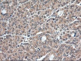 TRIM33 / TIF1-Gamma Antibody (clone OTI9D4)