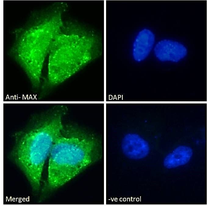 PathPlus™ MAX Antibody (aa147-160)