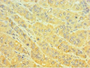 MTMR4 Antibody (aa570-820)