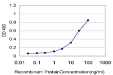 ST14 / Matriptase Antibody (clone 2F4)