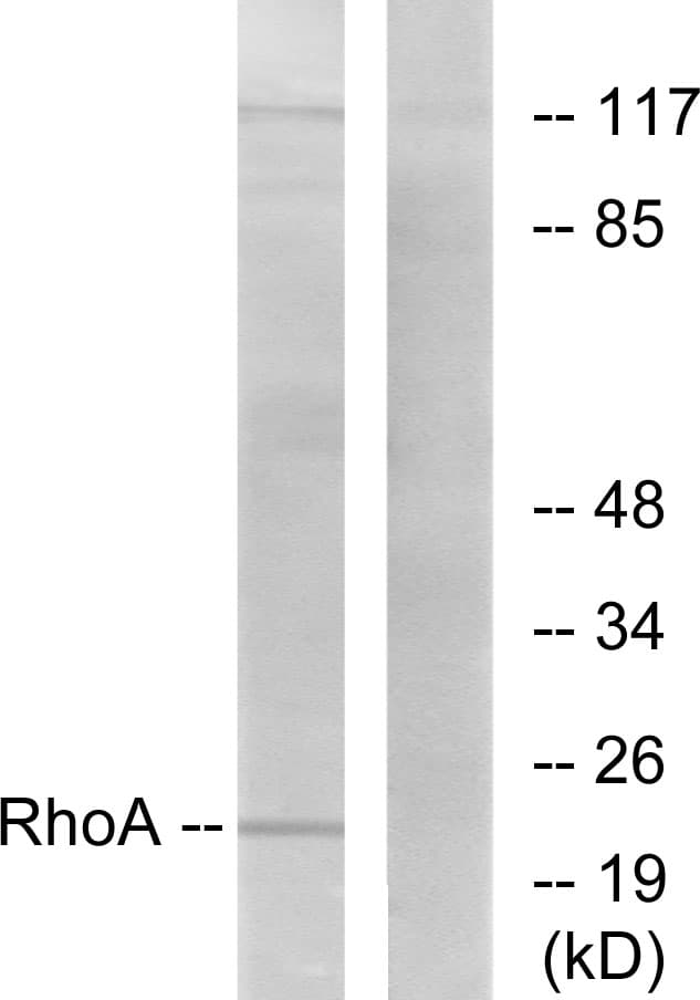 Polyclonal Rabbit anti-Human RHOA Antibody (aa144-193, IHC, WB)