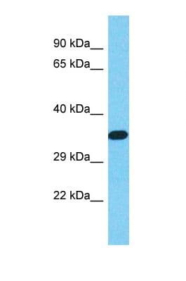 Polyclonal Rabbit anti-Human WDR61 Antibody (N-Terminus, WB)
