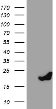PRDX5 / Peroxiredoxin 5 Antibody (clone OTI3A1)