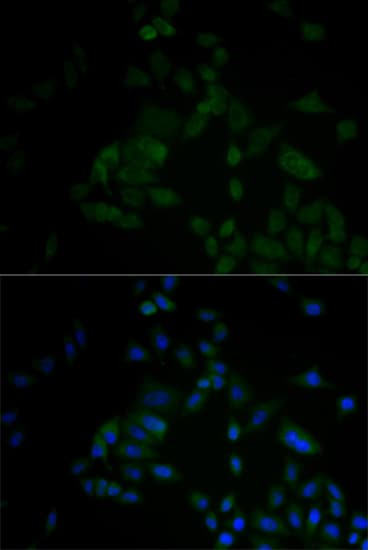 ARF6 Antibody