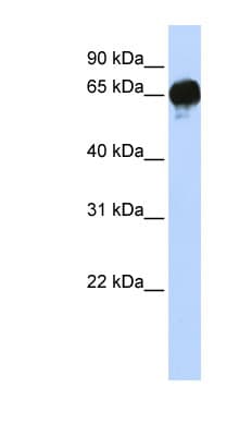 DGKE / DGK Epsilon Antibody (N-Terminus)