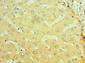 NR1I2 / PXR Antibody (aa175-434)