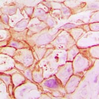 SLC25A12 / ARALAR Antibody (Internal)