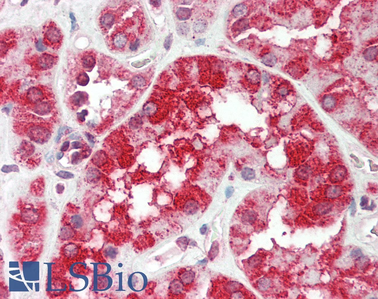 IDUA / MPS1 Antibody (aa121-170)