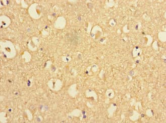 PSEN1 / Presenilin 1 Antibody