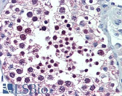 IHC-plus™ UBE1L2 / UBE1L2 Antibody (aa200-250)