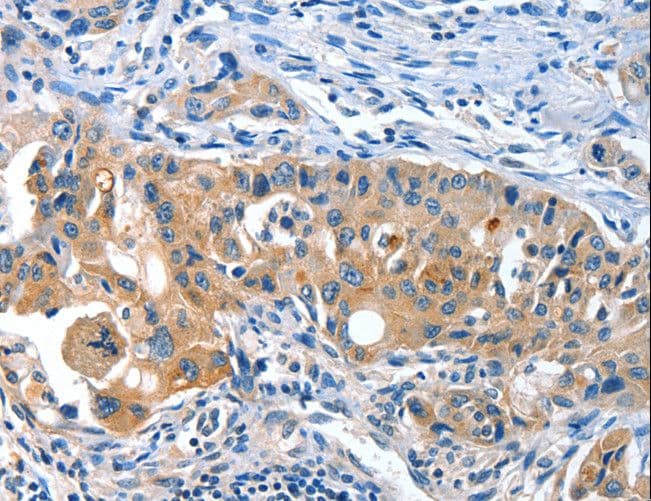 AMHR2 / MISRII Antibody