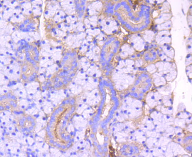 Rho Kinase / ROCK1 Antibody