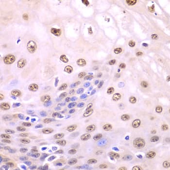 SQSTM1 Antibody