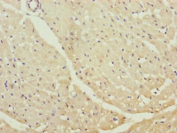 Polyclonal Rabbit anti-Human CETN1 Antibody (IHC)