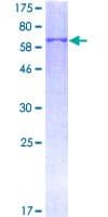 Human VCAN / Versican Protein (Recombinant GST)
