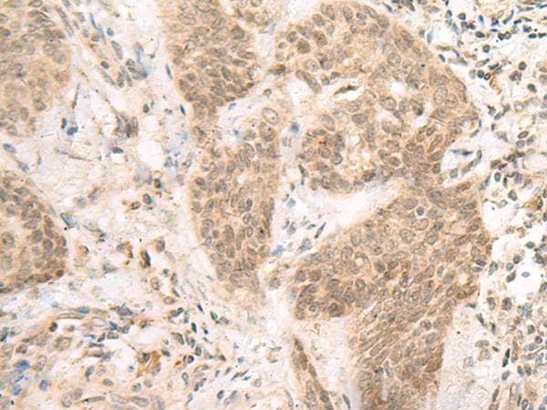 Polyclonal Rabbit anti-Human NATO3 / FERD3L Antibody (IHC)