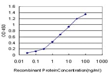 Monoclonal Mouse anti-Human TAF11 Antibody (clone 2G9, IHC, IF, WB)