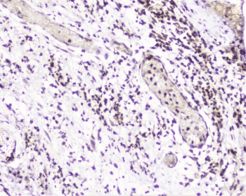 UBE2I / UBC9 Antibody