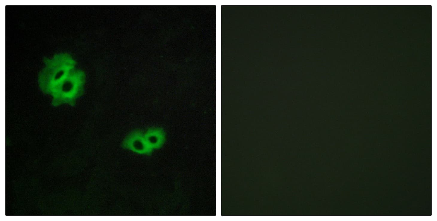 IHC-plus™ Polyclonal Rabbit anti-Human GPR171 Antibody (aa141-190, IHC, IF, WB)