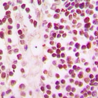 IHC-plus™ CREBBP / CREB Binding Protein Antibody (C-Terminus)
