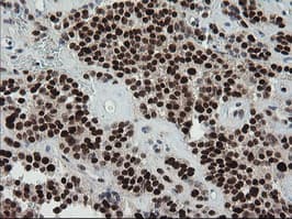 TRMT2A Antibody (clone OTI1H8, Carrier-free)