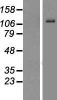 TMPRSS15 / Enterokinase Protein (Over-Expression Lysate Myc-DDK (Flag))