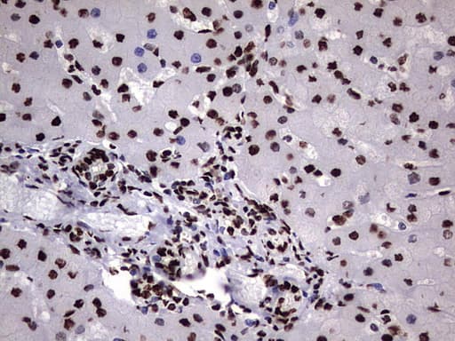 HNRPM / HNRNPM Antibody (aa1-261, clone OTI4C9)