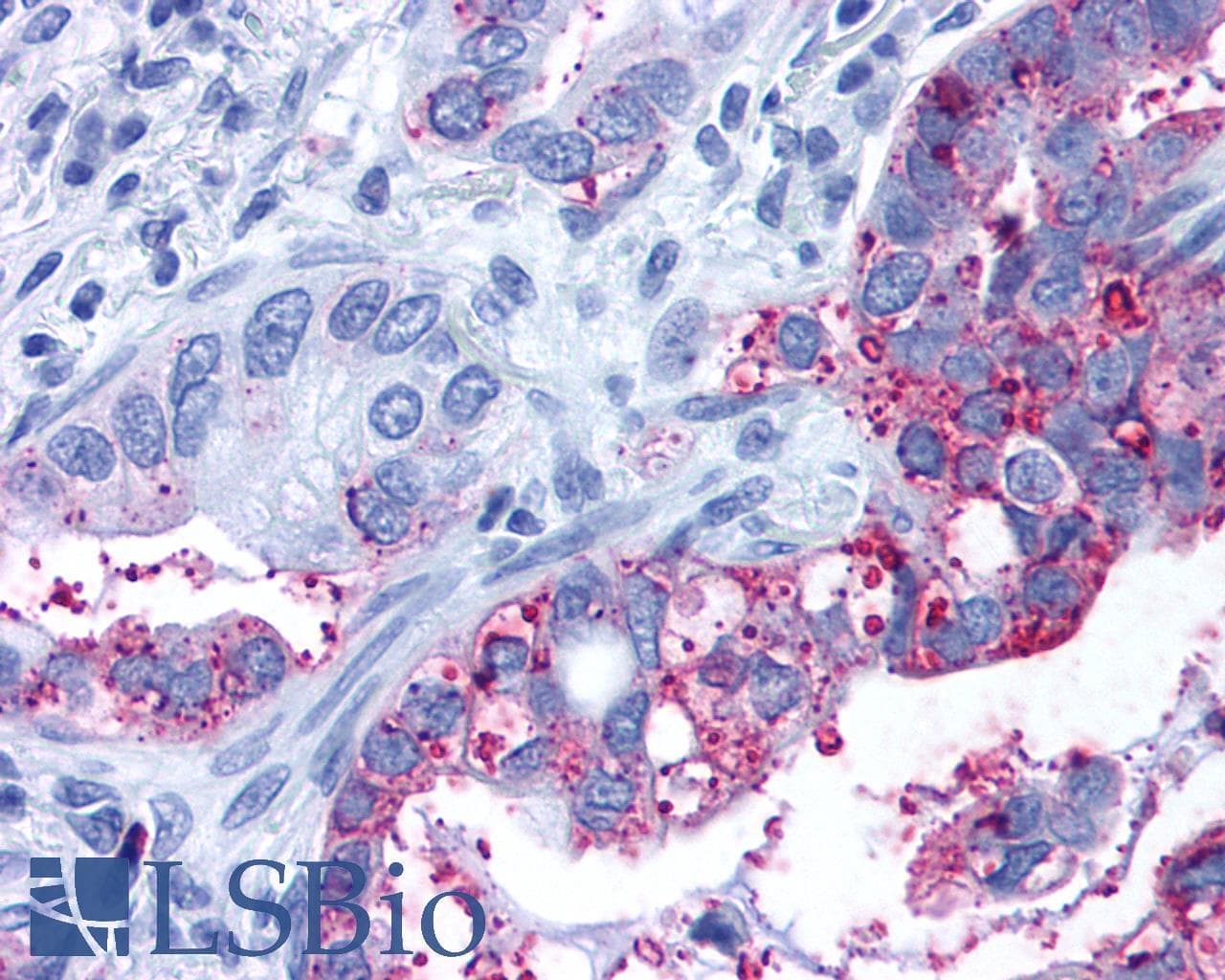 PathPlus™ Polyclonal Rabbit anti-Human GPR6 Antibody (C-Terminus, IHC)