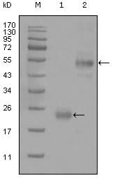 IHC-plus™ CD44 Antibody (clone 8E2F3)