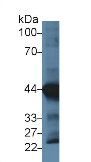ACTC1 / Alpha Cardiac Actin Antibody