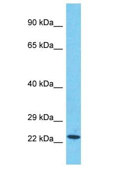 SCLT1 Antibody (aa614-663)