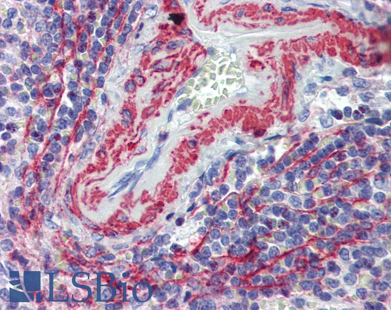 IHC-plus™ ITGA4 / VLA-4 / CD49d Antibody