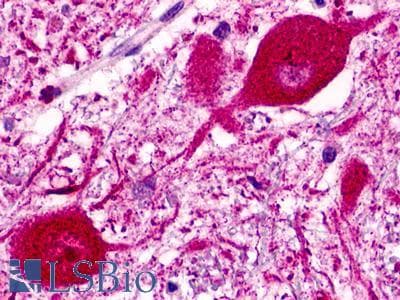 PathPlus™ NPFF2 / NPFFR2 Antibody (N-Terminus)
