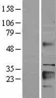 IGFBP6 Protein (Over-Expression Lysate Myc-DDK (Flag))