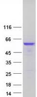 Human CPE / Carboxypeptidase E Protein (Recombinant Myc-DDK (Flag))