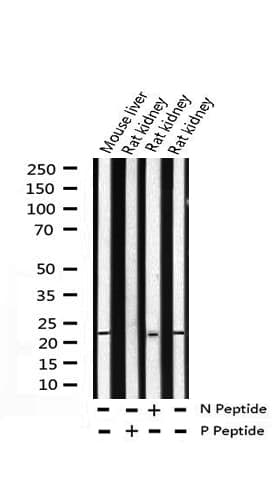 CAV1 / Caveolin 1 Antibody (phospho-Tyr14)