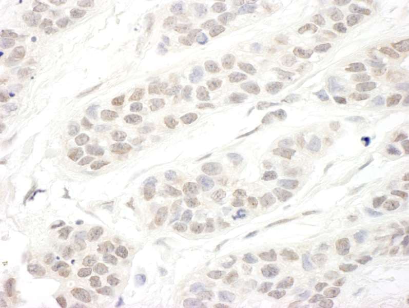 SETD1B / SET1B Antibody (aa1400-1450)